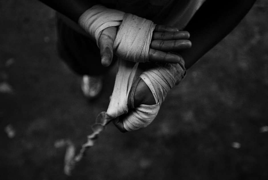 Manos vendadas en blanco y negro